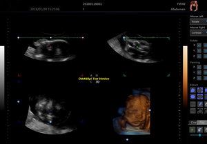 Ecógrafo 3D de 15 Pulgadas para Embarazo, Máquina de Ultrasonido Veterinario, Ecógrafo Doppler Color para Hospital de Cardiología - Product Image 4