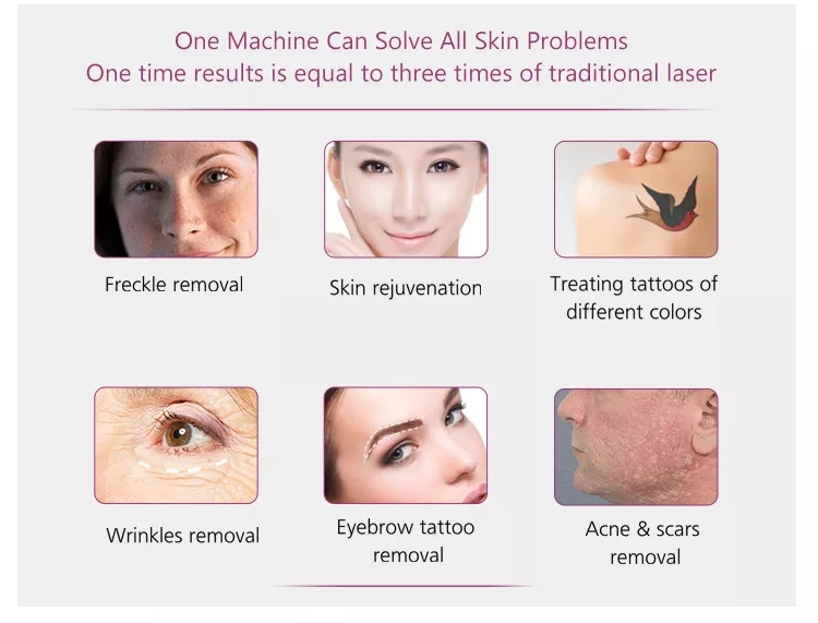 Stand 2 in 808nm diode hair removal and nd yag laser tattoo removal machine