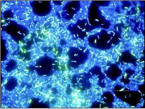 BestScope BS-2063FT(LED、TB) Trinocular LED蛍光生物顕微鏡 (<span class=keywords><strong>Tuberculosis</strong></span> Test用) - Product Image 6