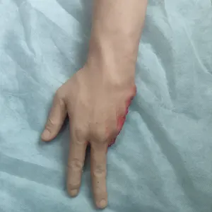 キレンメッド上肢の外傷とナイフ傷の切断モデル銃創の負傷は、縫合と切開手順を火傷します - Product Image 3