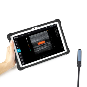 Sonda Rectal de Ultrasonido Portátil de Alta Resolución para Monitoreo Reproductivo <span class=keywords><strong>Bovino</strong></span> - Product Image 3
