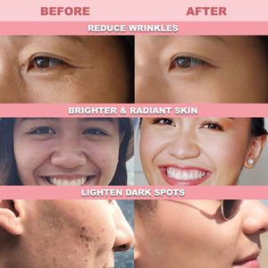 Barras de gelatina de konjac y colágeno de marca privada de alta calidad, bajas en calorías, para adelgazar y reafirmar la piel. - Product Image 4