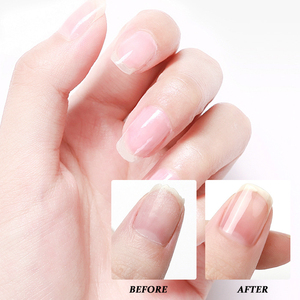 Private Label Hard Care Long-lasting Protection Boosts <b>Nail</b> Thickness Improves Toughness <b>Nail</b> <b>Hardener</b> - Product Image 2