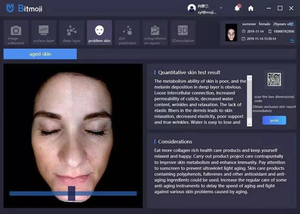 2025เครื่องสแกนผิวหน้าเครื่องวิเคราะห์ผิวระบบสัมผัสแบบพกพาเครื่องวิเคราะห์ผิวหน้า - Product Image 5
