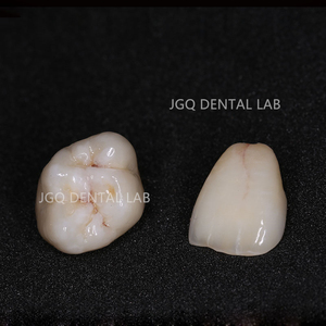 <span class=keywords><strong>CAD</strong></span> cam sẵn sàng Zirconia crowns nhanh hơn phay <span class=keywords><strong>STL</strong></span> tập tin hỗ trợ 3 hình dạng exocad tương thích - Product Image 2