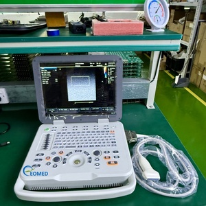 Système d'échographie Doppler couleur portable haute résolution à LED de 15 pouces pour usage médical, échographie de grossesse, échographie vétérinaire CU20-2vet - Product Image 5