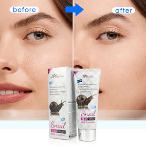 <span class=keywords><strong>Dr</strong></span>. Roseva Huidverzorging Van Gezichtsreiniger Sulfaatvrije Olie Controle & Anti-Acne En Aloë Vera & Slak Gezicht Wassen Voor Alle Huid - Product Image 1