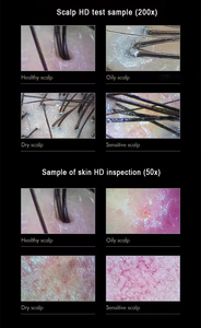 Escáner de Cuero Cabelludo Portátil y Analizador de Cabello - Detector Profesional de Folículos Pilosos para la Salud del Cuero Cabelludo, Análisis de la Caída del Cabello y Tratamiento - Product Image 6