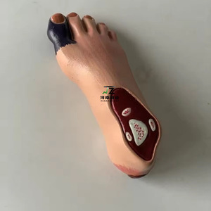 Modelo de Enseñanza de Ciencias Médicas, Patología Humana, <span class=keywords><strong>Diabetes</strong></span>, Anatomía <span class=keywords><strong>en</strong></span> PVC para Escuelas de Medicina - Product Image 3