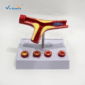 血管教育科学モデル学生向け医療教育用品 - Product Image 4