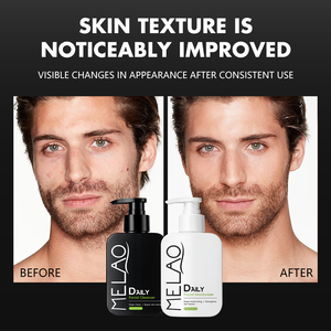 Nettoyant pour le visage <span class=keywords><strong>de</strong></span> marque privée purifiant huileux moussant nettoyant pour le visage coréen femmes hommes huile nettoyante pour le visage bio - Product Image 5