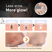 Appareil de microdermabrasion de bureau, machine de peeling à jet d'eau, machine de dermabrasion pour le visage, machine de rajeunissement de la peau, machine de nettoyage du visage, machine de beauté