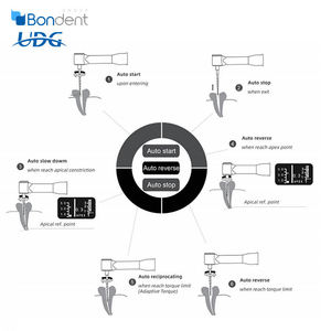 Endomoteur <span class=keywords><strong>UDG</strong></span> avec localisateur d'apex Moteur Endo Wismy IRoot Eco CE et ISO Verify Endo Motor avec localisateur d'apex Dispositif dentaire <span class=keywords><strong>UDG</strong></span> - Product Image 4