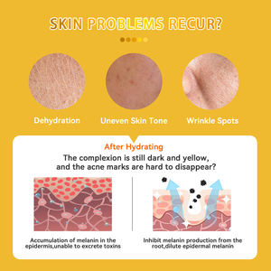 <span class=keywords><strong>DR</strong></span>.ROSEVA Extracto de arroz Tónico facial Natural Orgánico Niebla facial Hidratante Cuidado DE LA PIEL Spray Tónico facial - Product Image 5