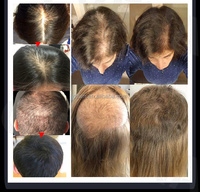 Huile d'argan et romarin naturel de marque privée avec logo personnalisé Sérum de traitement capillaire anti-chute Huile de repousse des cheveux à la biotine