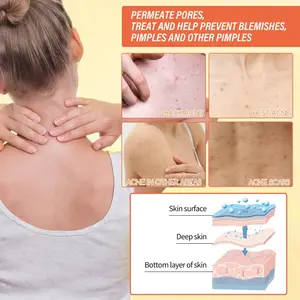 Hot Selling Wholesale Private Logo Handmade Bath Soap Brightening Whitening Lighten Skin <b>Care</b> Kojic Acid Soap Bar - Product Image 6