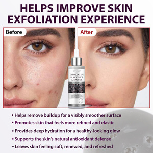 Ikzee Private Label 100mL Exfoliante facial <span class=keywords><strong>y</strong></span> corporal Suero EXFOLIANTE SUAVE Ampolla peladora de arroz blanco <span class=keywords><strong>y</strong></span> negro para removedor de piel muerta - Product Image 4