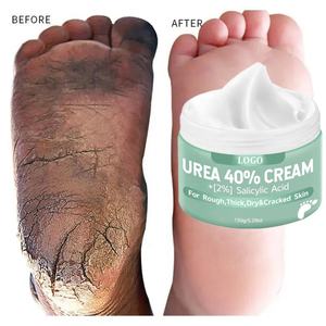 Crema OEM para el Cuidado de Manos y Pies, Hidratante, Nutritiva, Elimina Callosidades y Grietas, con 2% de Ácido Salicílico y 40% de Urea - Product Image 6