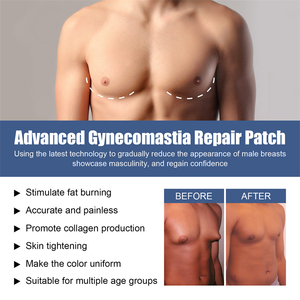 Patch oem East <span class=keywords><strong>moon</strong></span> pour hommes patch de réparation avancée de gynécomastie patch de réparation de la gynécomastie avancé pour soulager la sensibilité des seins et soulager la combustion des graisses - Product Image 6