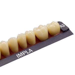 Bestseller: Grande Impianto Dentale Manuale IMPLA a Cinque Strati, Protesi Completa di Alta Qualità per Tecnici di Laboratori Odontoiatrici - Product Image 3