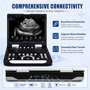 Appareil d'échographie portable avec écran LCD de 15 pouces, scanner de diagnostic vétérinaire avec SSD de 128 Go, système d'<span class=keywords><strong>imagerie</strong></span> clinique de 4,8 kg - Product Image 4