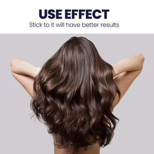 Aceite Natural a Base de Hierbas <span class=keywords><strong>para</strong></span> el Crecimiento <span class=keywords><strong>del</strong></span> <span class=keywords><strong>Cabello</strong></span>, Anticaspa, Anticaída, Fórmula Concentrada, Hidrata Profundamente, Repara el <span class=keywords><strong>Cabello</strong></span> Seco y Áspero, Fortalece - Product Image 3