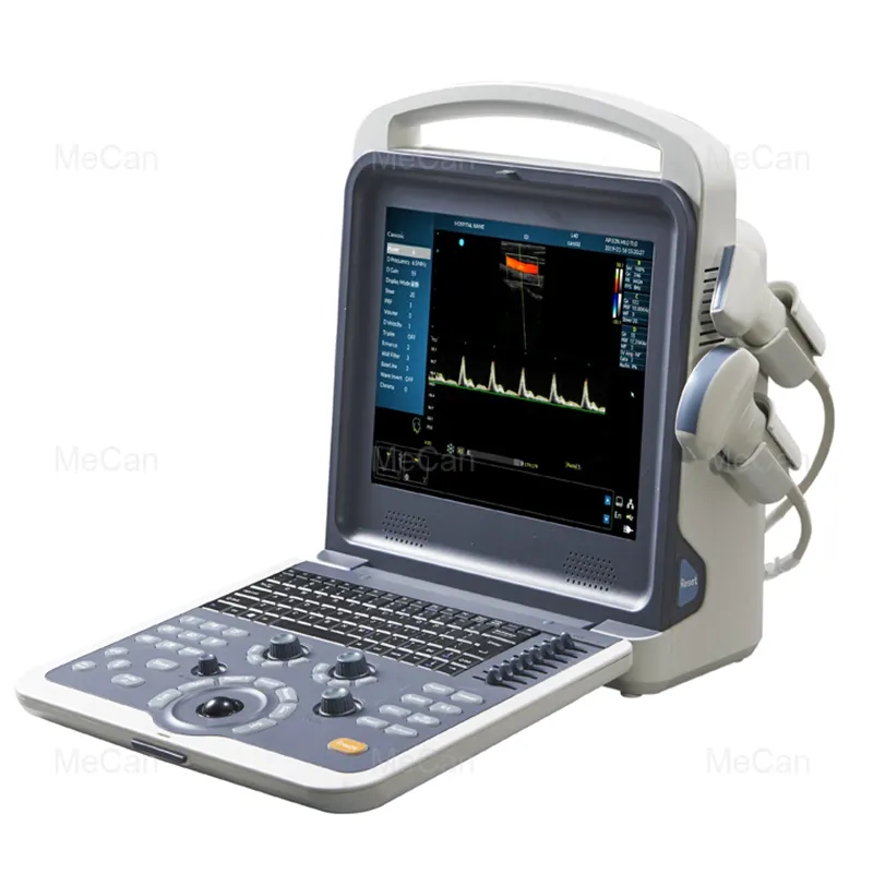 Système de contrôle d'ultrason Portable, Doppler numérique de couleur, Scanner ultrasonique