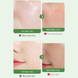 सेंटेला सियाटिका निकालें कोलेजन इंजेक्शन एंटी-इंफ्लेमेटरी एंटीबैक्टीरियल त्वचा की मरम्मत चेहरे के लिए चेहरे मॉइस्चराइजिंग मास्क - Product Image 2