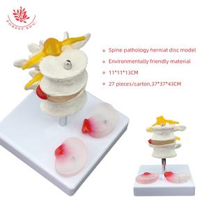 Modèle de lésion de la colonne vertébrale lombaire FRT038 modèle de pathologie vertébrale à deux segments du disque lombaire enseignement des étudiants en médecine - Product Image 6