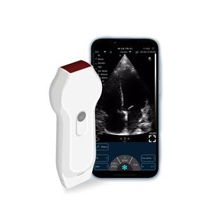 Ultrasound Nirkabel Wifi Probe Tipe 3 In 1 Kepala Probe Ultrasound Doppler Warna Mini Nirkabel - Product Image 2