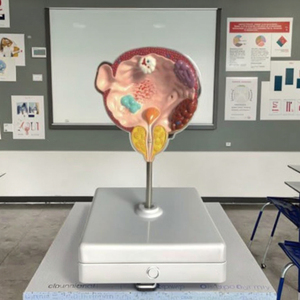 Enfermedades <span class=keywords><strong>de</strong></span> la vejiga y la próstata, modelo <span class=keywords><strong>de</strong></span> anatomía humana médica, patologías del sistema urinario masculino - Product Image 4