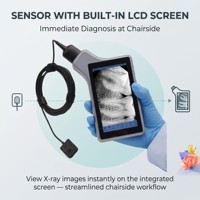 Nuevo Sistema de Imágenes Digitales Portátil con Sensor y Pantalla, Sistema de Imágenes Intraorales para Diagnósticos Inmediatos