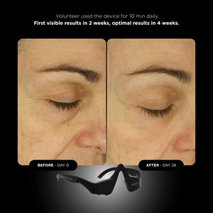Masque pour les yeux UNICTECH 5.0 - TECHNOLOGIE AVANCÉE JOUR/NUIT LED + NIR + EMS - MODE ET TENDANCE POUR LA ZONE DES YEUX - Réduit l'apparence des cernes et des taches - Product Image 5