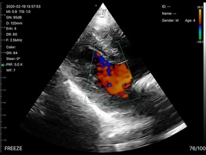B26E Cardiac <span class=keywords><strong>Abdominal</strong></span> Vascular 3 en 1 Aplicación de clínica inalámbrica portátil Equipo de ultrasonido de diagnóstico de escaneo dual para móvil - Product Image 4