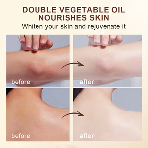 מרכיבי קרם מותג פרטי רטינול פרח אספרגוס ארביטין ויטמין C קרם הלבנה כפולה - Product Image 4