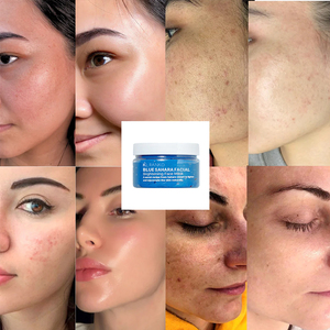 <span class=keywords><strong>Mascarilla</strong></span> de arcilla de nicotinamida OEM ODM tratamiento de pigmentación de brillo refinación de poros <span class=keywords><strong>mascarilla</strong></span> Facial antienvejecimiento <span class=keywords><strong>para</strong></span> piel radiante brillante - Product Image 6