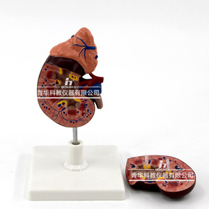 Modèle de rein humain ; anatomie du rein ; modèle agrandi de la glande surrénalette ; rein malade ; anatomie des organes internes humains. - Product Image 2