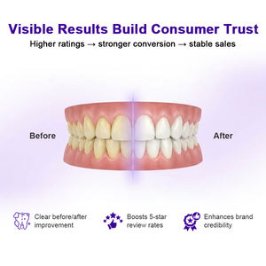Luxsmile Kit De Traitement Blanchissant Les Dents Personnalisé Conforme UE Sans Peroxyde PAP 14 Traitements Bandes Blanchissantes V34 Violettes Marque Privée - Product Image 4