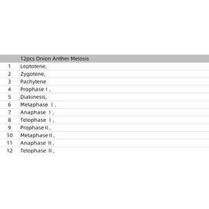 Útiles escolares Juego de alta calidad 5 piezas <span class=keywords><strong>Cebolla</strong></span> Raíz Punta <span class=keywords><strong>Cebolla</strong></span> y 12 piezas Meiosis Preparado Portaobjetos de <span class=keywords><strong>microscopio</strong></span> - Product Image 2