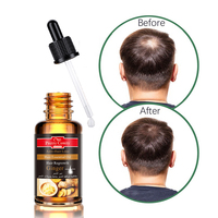 Solution nourrissante pour cheveux, adoucissante, huile pour croissance des cheveux au gingembre, soin capillaire