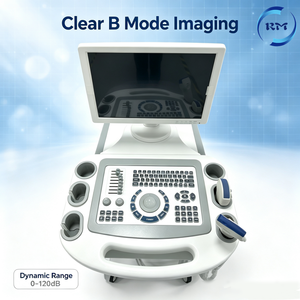 Carrito de Ultrasonido Modo B al Mejor <span class=keywords><strong>Precio</strong></span>, Carrito con Monitor de 15 Pulgadas, Multifrecuencia, Mediciones OB/GYN para Diagnóstico en Hospitales y Clínicas - Product Image 4