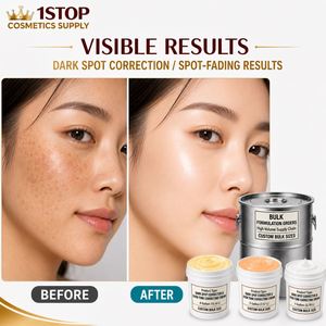 Crema Blanqueadora Aclarante para la Piel del Rostro, Eliminación de Pecas y Hiperpigmentación, Soporte para Lanzamiento de Marca Cosmética - Product Image 1