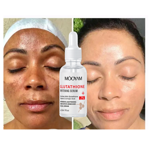 <span class=keywords><strong>เซ</strong></span><span class=keywords><strong>รั่</strong></span><span class=keywords><strong>ม</strong></span>กลูต้าไธโอน ผิวขาวใส <span class=keywords><strong>ลด</strong></span>ฝ้า กระ จุดด่างดำ ด้วยโคจิก แอซิด และวิตามินซี - Product Image 1