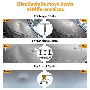 Kits <span class=keywords><strong>de</strong></span> réparation <span class=keywords><strong>de</strong></span> bosses sans démontage pour véhicules en aluminium – Outils essentiels pour la réparation rapide des bosses <span class=keywords><strong>de</strong></span> grêle sur la carrosserie <span class=keywords><strong>de</strong></span> voiture - Product Image 2
