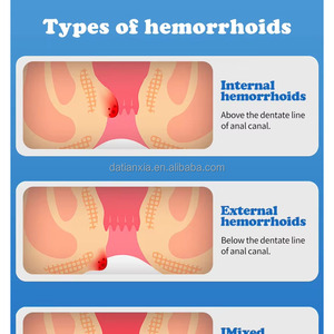 ครีมริดสีดวงทวารมิ้นท์ครีมรอยแยกทางทวารหนักทั้งภายในและภายนอกช่วยบรรเทาอาการปวดรอยแยกทางทวารหนักทั้งภายในและภายนอก - Product Image 5