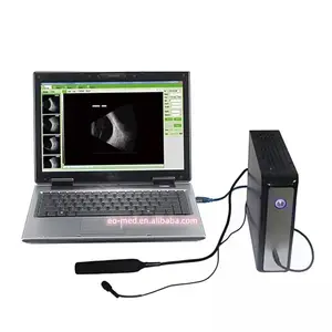 Nieuwste Goedkope Eye Apparatuur Digitale Oogheelkundige Scanner Machine Met Een/B Scanner Doos EUS500T