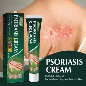 Krim Psoriasis Ekstrak Herbal Kulit, Krim Anti Gatal, Pereda Nyeri Bengkak, Perbaikan Kulit