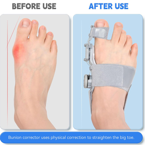 Support pour Hallux Valgus, Antidérapant, Respirant, en Silicone Souple, Confort Toute la Journée, Design Flexible pour <span class=keywords><strong>Redresser</strong></span> les Orteils, Pour Orteils Recourbés, Gris - Product Image 2