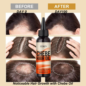 Huile <span class=keywords><strong>de</strong></span> <span class=keywords><strong>Chebe</strong></span> pure naturelle <span class=keywords><strong>de</strong></span> marque privée d'usine 100ML Huile <span class=keywords><strong>de</strong></span> soin capillaire pour la prévention <span class=keywords><strong>de</strong></span> la perte <span class=keywords><strong>de</strong></span> cheveux Nourrissante et rafraîchissante <span class=keywords><strong>Poudre</strong></span> <span class=keywords><strong>de</strong></span> <span class=keywords><strong>Chebe</strong></span> - Product Image 2