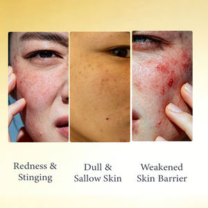 เซรั่มวิตามินซี Acerola สูตรเฉพาะเพื่อผิวกระจ่างใส ไนอะซินาไมด์ ลดเลือนจุดด่างดำ ปรับสีผิวให้สม่ำเสมอ รับผลิตแบบ OEM/ODM ขายส่ง - Product Image 4